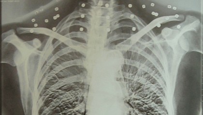 “老先生,您把项链取下来再做CT”